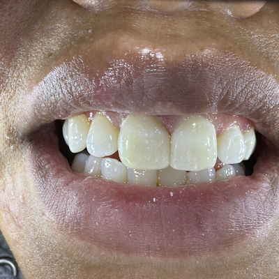 2025 12 02 Catapult Universal Composites 400