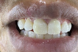 2025 12 02 Catapult Universal Composites 400