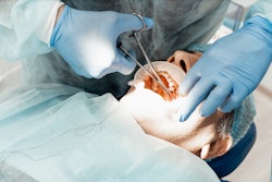 Dental Implant Placement