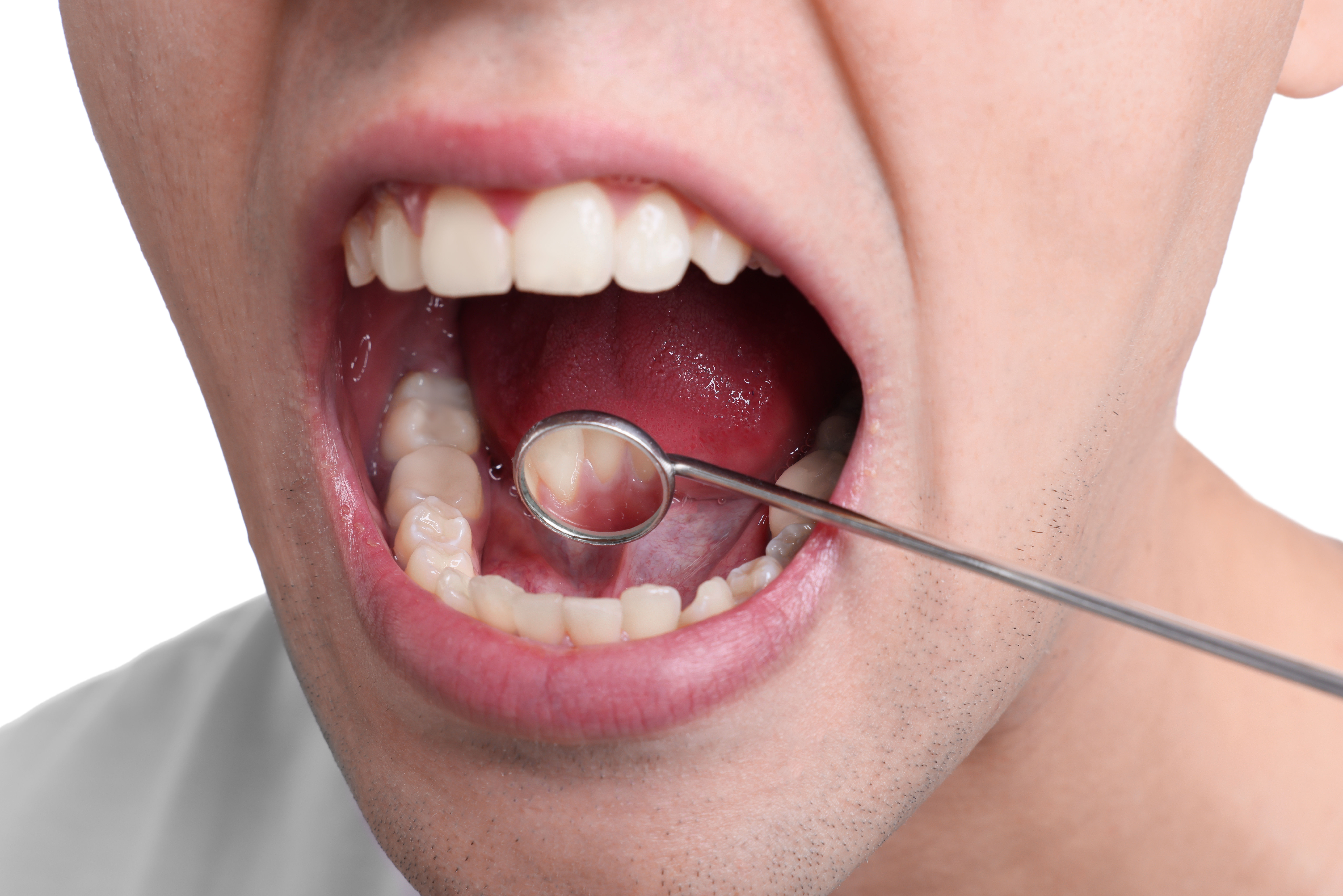 Mouth Dental Mirror New Africa