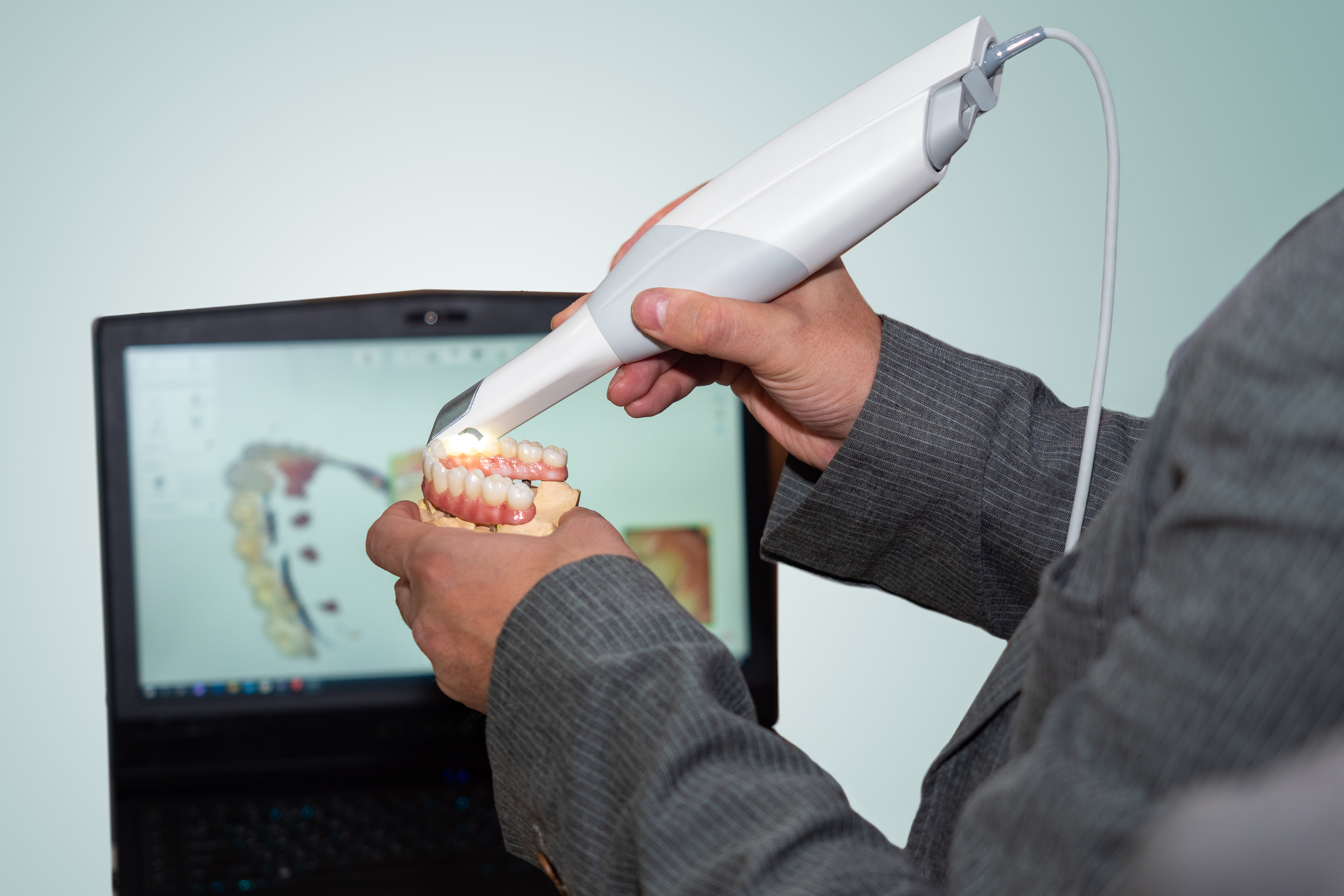 Scanner Intraoral Dental