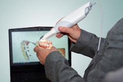 Scanner Intraoral Dental