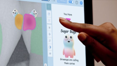 Second Opinion for Kids displays AI-detected cavities as 'sugar bugs,' making it easier for dentists to explain oral health to young patients.