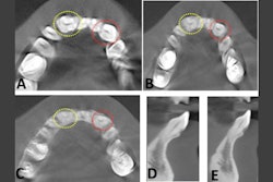 2026 01 15 Case Report Fused Teeth 400