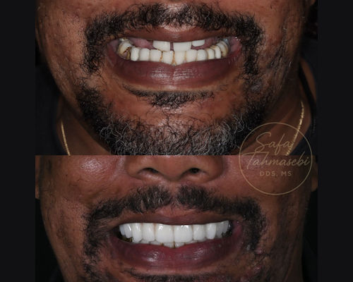 2026 01 28 Gunshot Facial Trauma Tahmasebi 400