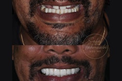 2026 01 28 Gunshot Facial Trauma Tahmasebi 400