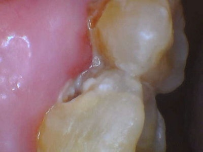 2026 02 Catapult Riva Sc Fig1