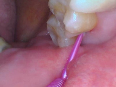 2026 02 Catapult Riva Sc Fig2