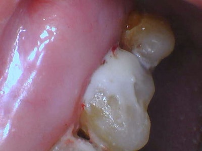 2026 02 Catapult Riva Sc Fig3