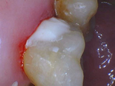 2026 02 Catapult Riva Sc Fig4