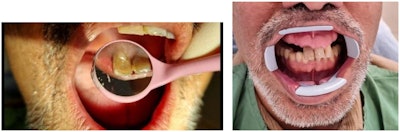 Fig. 1: Initial images.