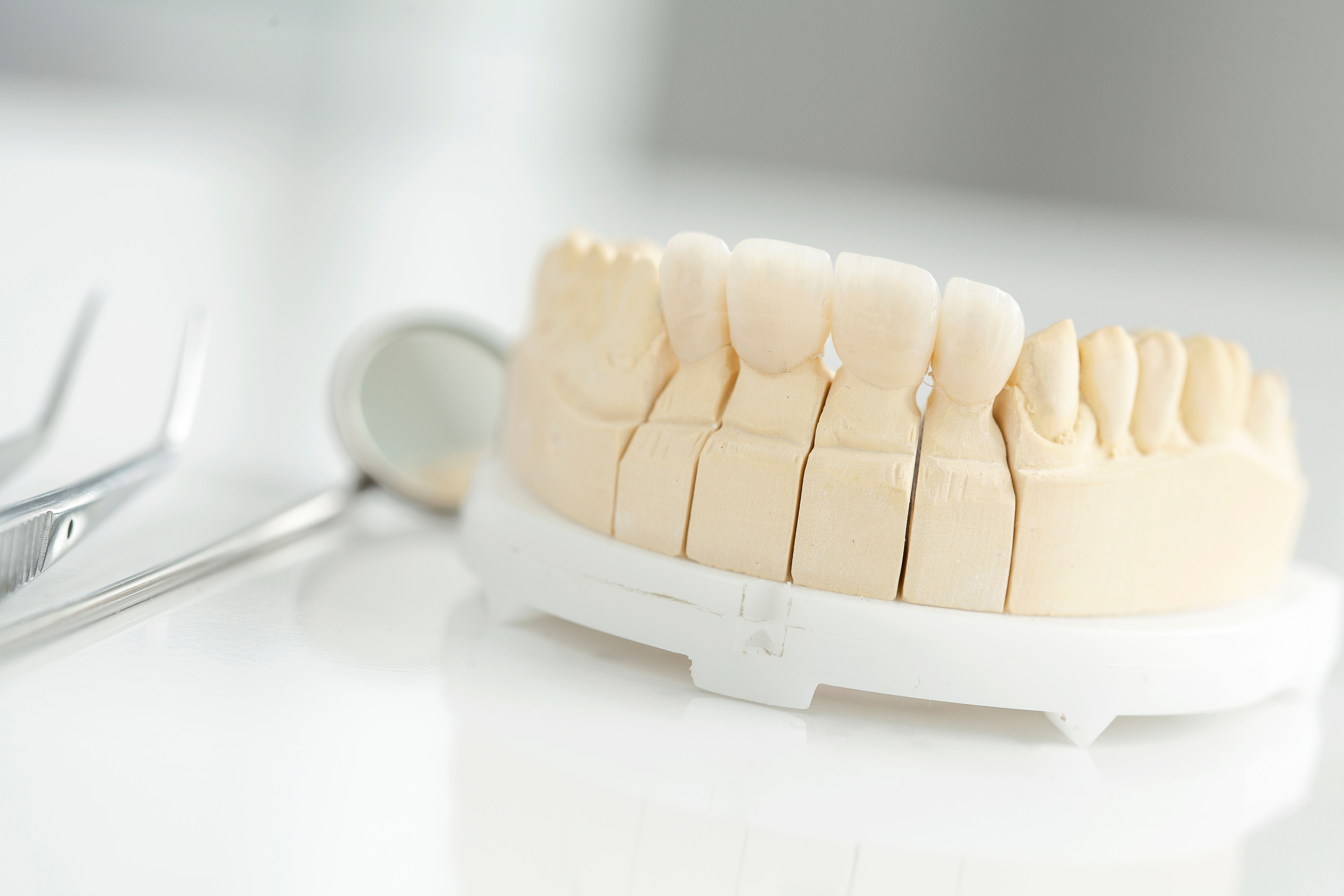 Ceramic Dental Bridge Sebra
