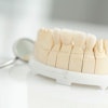 Ceramic Dental Bridge Sebra