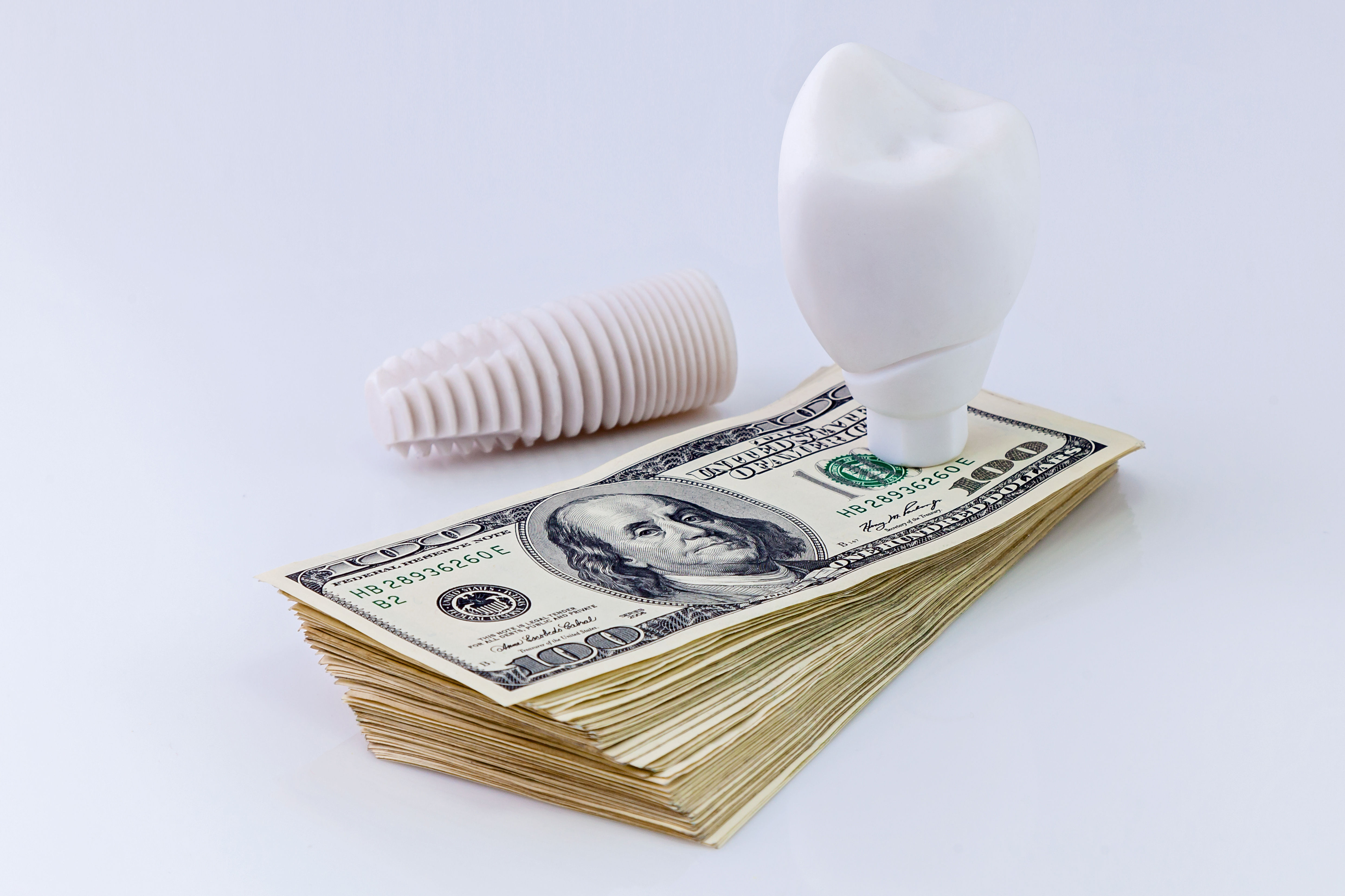 Dental Implant Money Oleg
