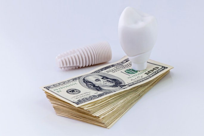 Dental Implant Money Oleg