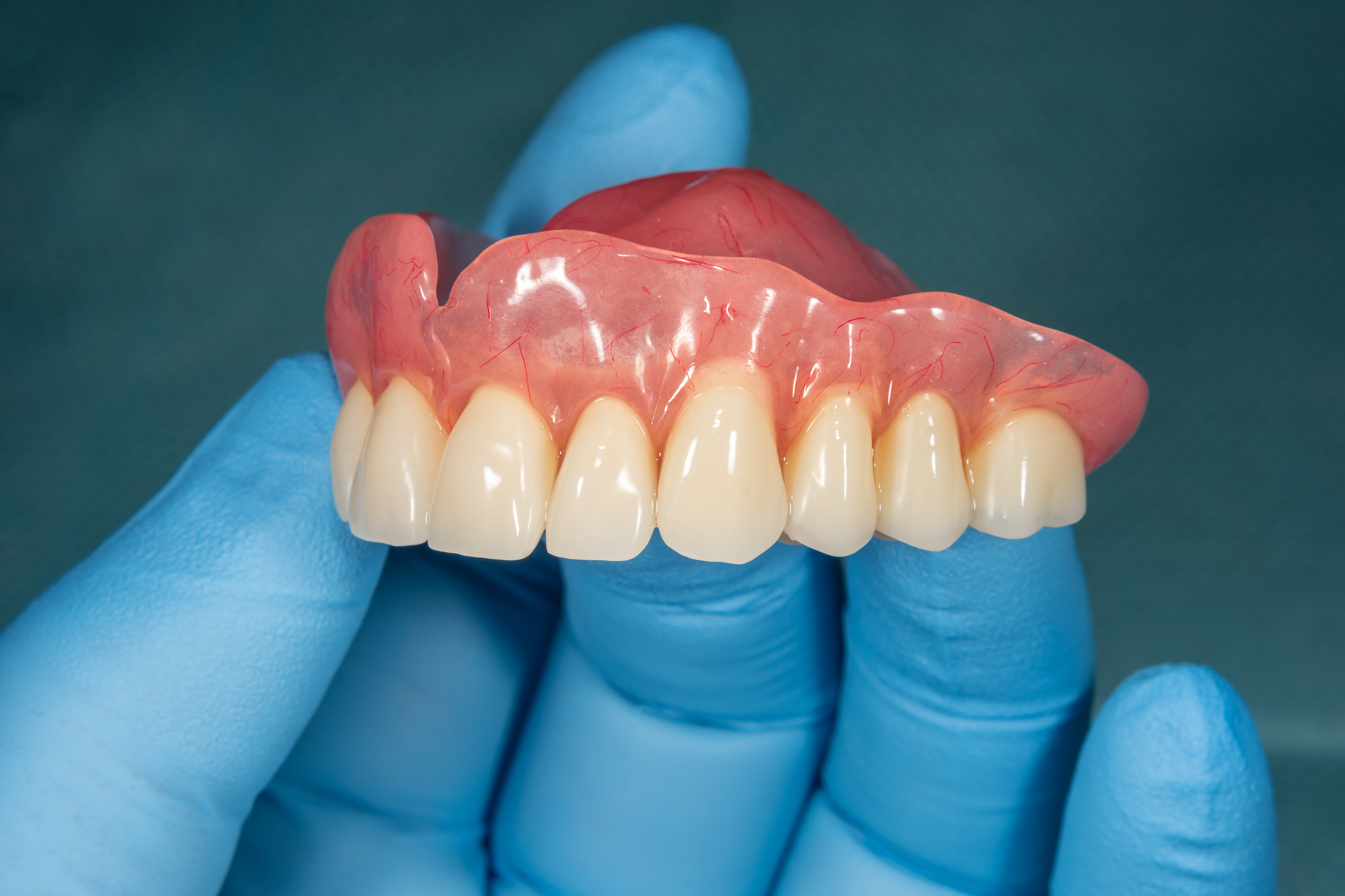 Denture Upper