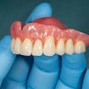 Denture Upper