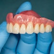 Denture Upper