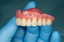 Denture Upper