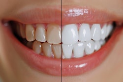 Smile Design Lime Sky