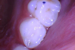 2026 03 Catapult Luna2 400