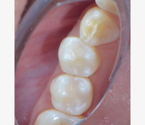 Catapult Visalys Bulk Flow 400