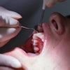 Dental Patient Periodontal Exam