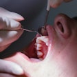 Dental Patient Periodontal Exam