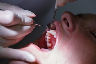 Dental Patient Periodontal Exam