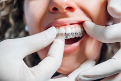 Dentist Installing Aligner Karrastock