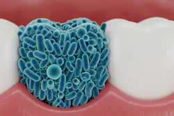 Tooth Biofilm Jibon