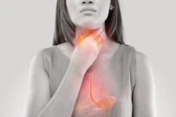 Woman Acid Reflux Eddows