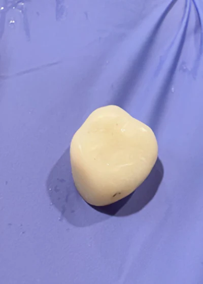 Figures 3 and 4: Not only does the material exhibit uniquely high strength and resistance to fracture, its polishability is incredible, especially when using abrasive finishing disks.