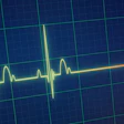 Ekg Death Portokalis