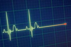 Ekg Death Portokalis