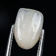 Tooth Veneer Mrs Jpeg