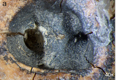 2026 05 28 Neanderthal Root Canal 400