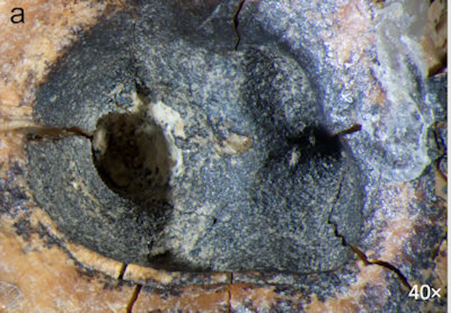 Neanthal Rottip Did Neanderthals invent the root canal? | DrBicuspid.com