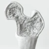 Bone Density Crevis