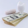 Dental Implant Money Oleg
