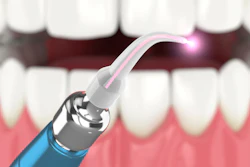 Dental Laser