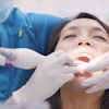 Dental Scaling Woman