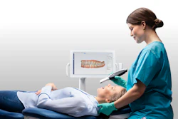 The Planmeca Onyx intraoral scanner.
