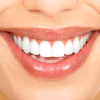Smile3