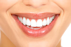 Smile3