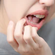 Mouth Ulcer Pain Thitiporn
