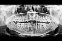 Xray Sinus Msc