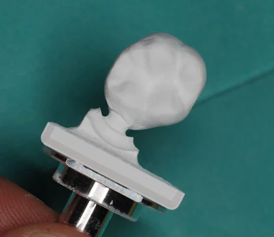 Figure 3: Katana Zirconia One Speed full-coverage crown was designed in CEREC software and milled with CEREC Primemill.