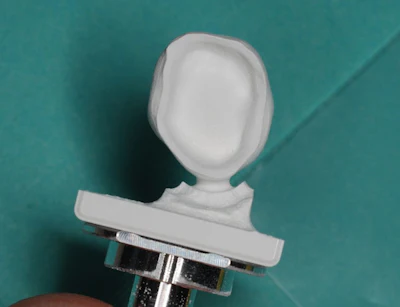 Figure 4: Intaglio view of the milled Katana Zirconia One Speed full-coverage crown.
