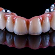 Arch Bridge Implant
